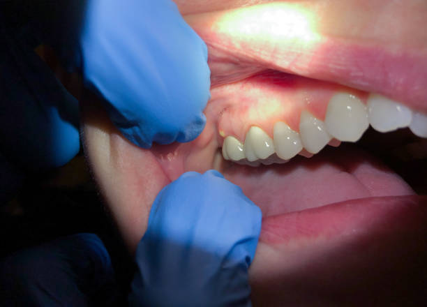 Best Emergency TMJ Treatment in Progress Village, FL